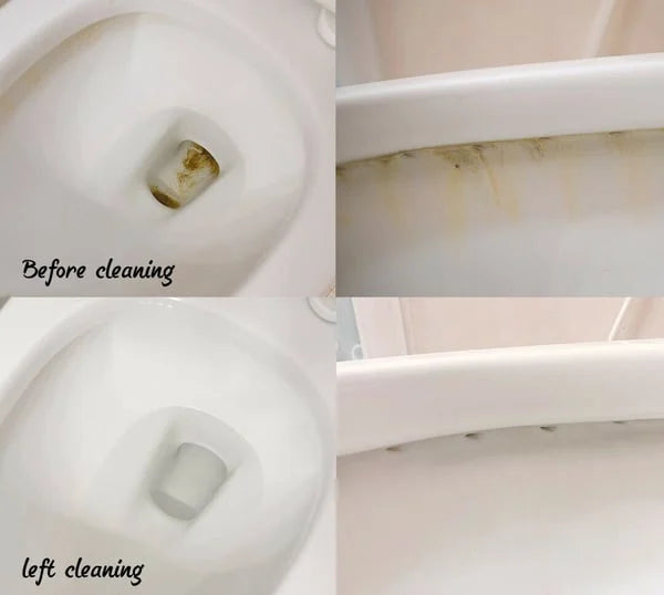 RinseFreeĀ® Powerful Stain Removal Kit
