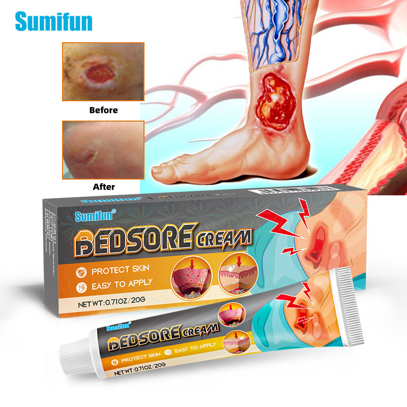 Bedsore cream-Decubitus ulcer treatment cream to solve your worriesđ„