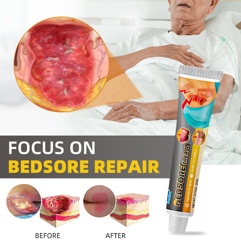 Bedsore cream-Decubitus ulcer treatment cream to solve your worriesđ„