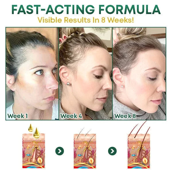 Last Day Promotion 45% OFF - š„Ginseng Hair Regrowth Serum Spray