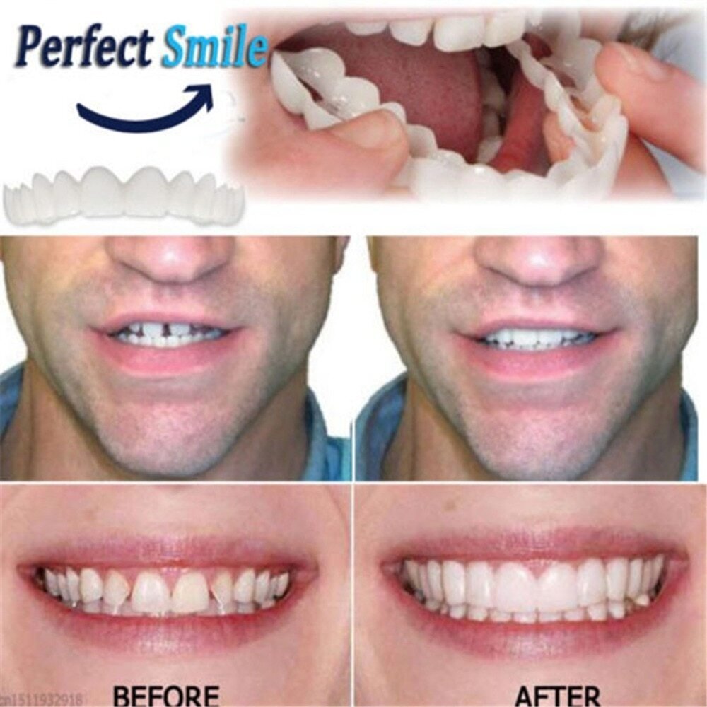 👨⚕Adjustable Snap-On Dentures😁100% non-inductive fit, no foreign body sensation!😁 (💥45% OFF) - 🔥HOT SALE🔥🎉