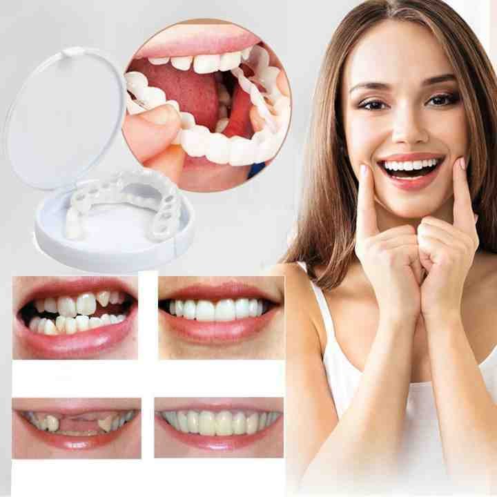 👨⚕Adjustable Snap-On Dentures😁100% non-inductive fit, no foreign body sensation!😁 (💥45% OFF) - 🔥HOT SALE🔥🎉
